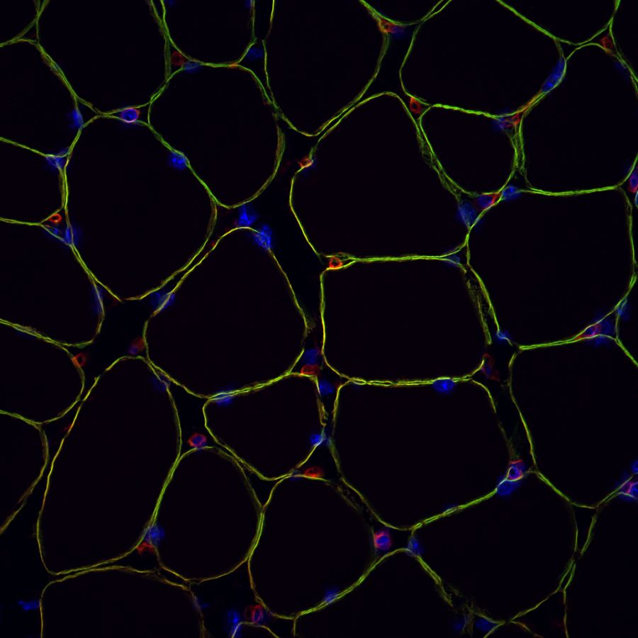 Rare Diseases Research image