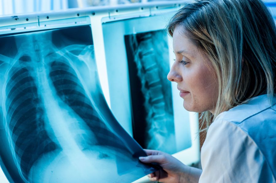 TB (Tuberculosis) Screening image