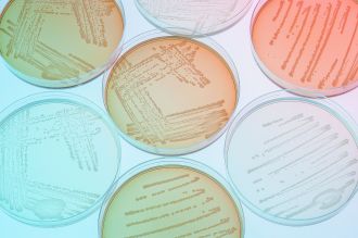 Petri dishes