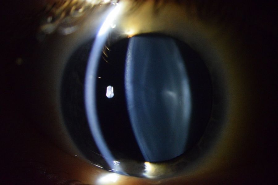 Novel ophthalmic imaging image